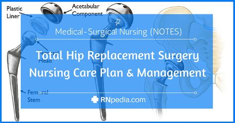 Total hip and total knee replacement: postoperative nursing .